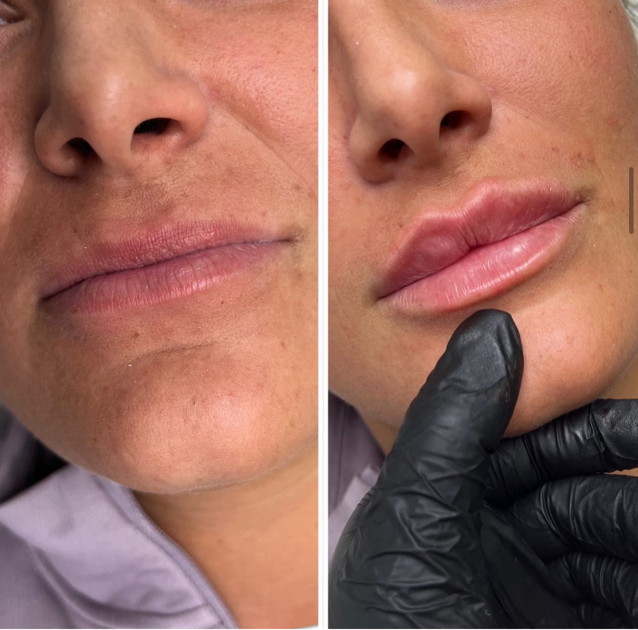 Dissolve & Refill Lip Package